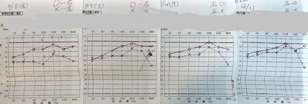 SSHLはどのように扱われますか?