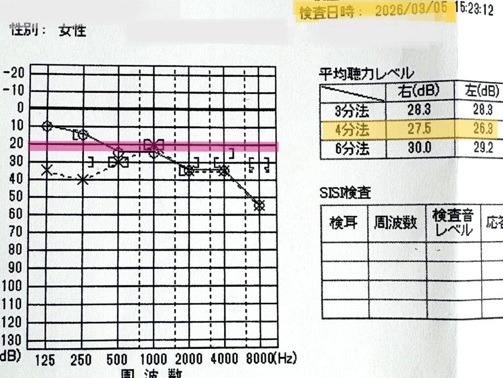 メニエール経過観察の2026年03月05日 聴力検査結果