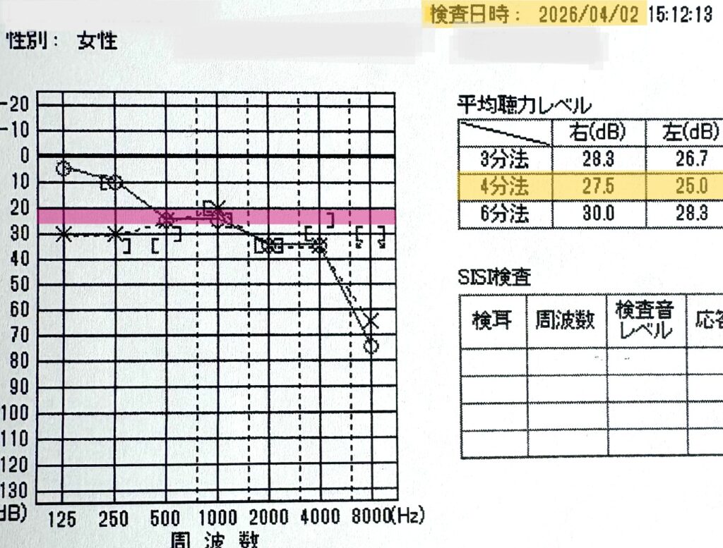 メニエール病の経過観察として記録された2026年4月2日の聴力検査