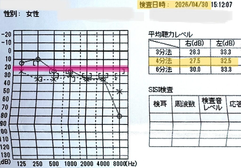 メニエール病の経過観察としての2026年4月30日の聴力検査