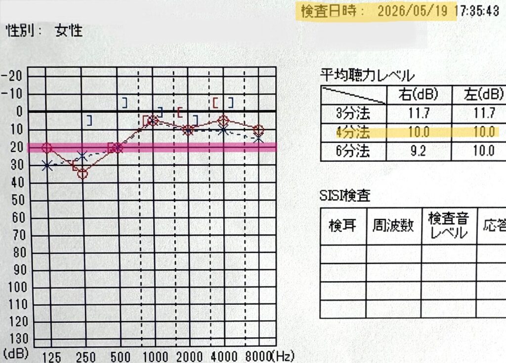 低音障害型感音難聴発症から9ヶ月後の2026年5月19日聴力検査